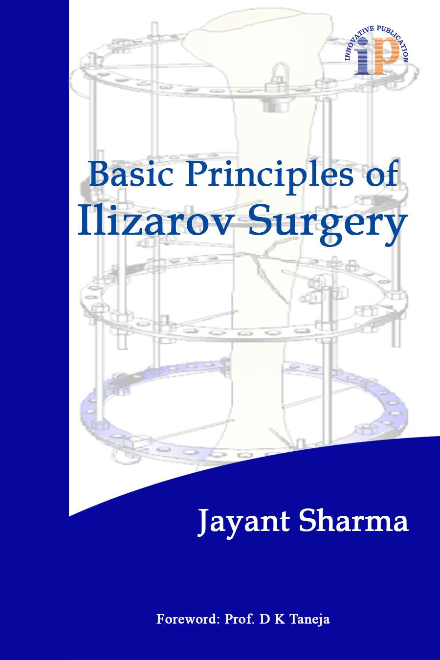 Basic Principles of Ilizarov Surgery - Orthopaedics